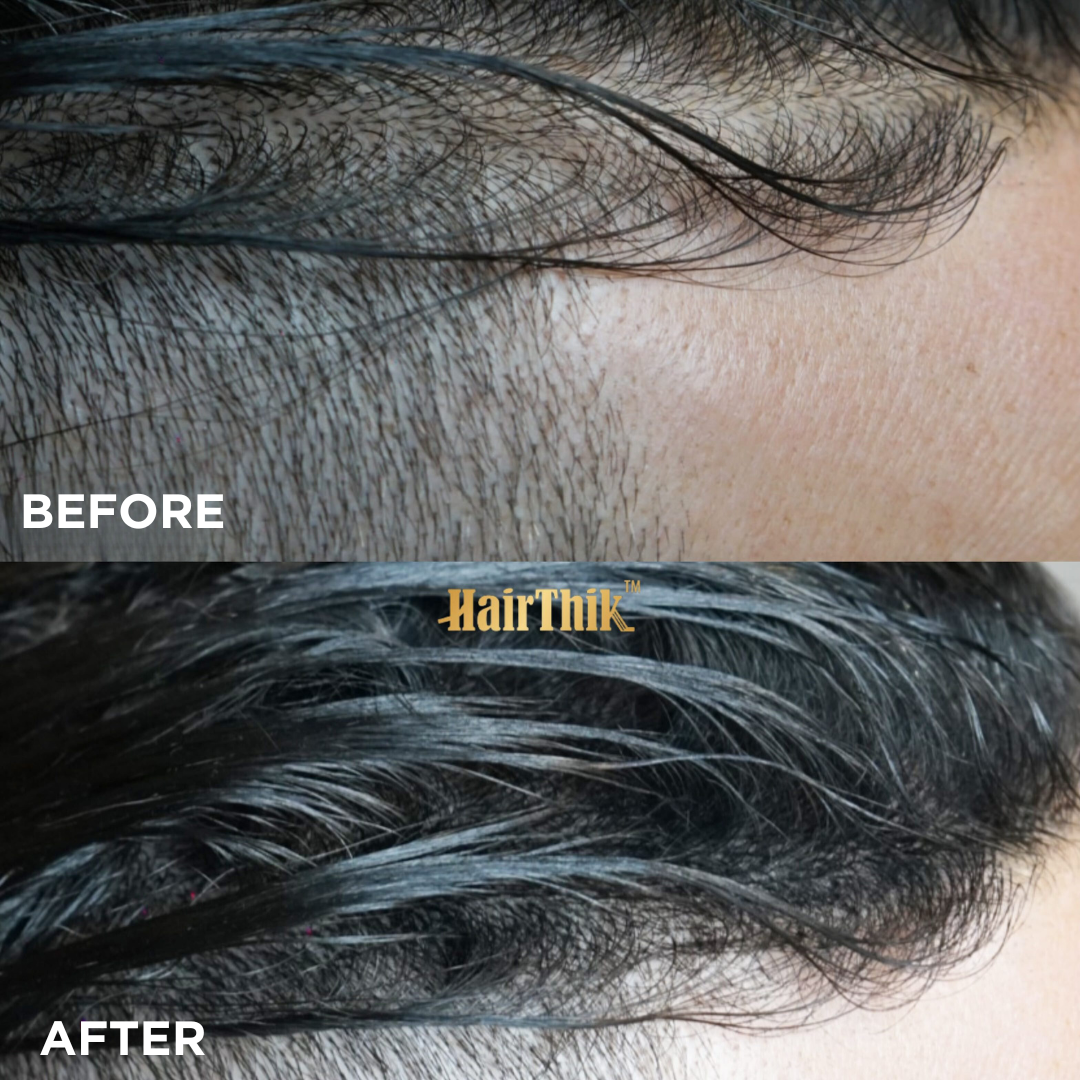 Supreme Trimmer HairThik 11-in-1 hair fiber kit – hairline enhancement accessories