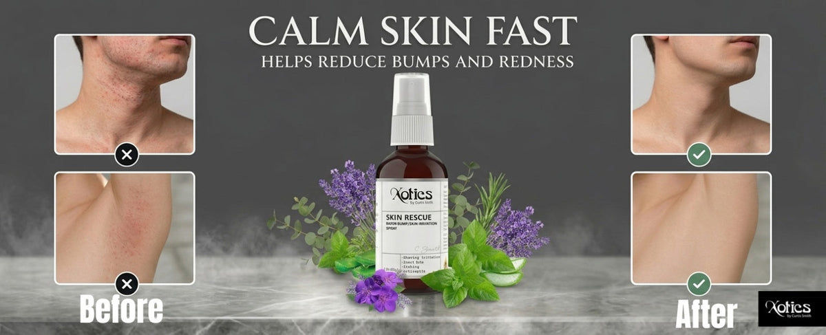 Xotics Skin Rescue Spray CS5012 alternate product view